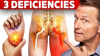 The 3 Vitamin Deficiencies in Sciatica and Carpal Tunnel Syndrome [upl. by Enelyahs872]