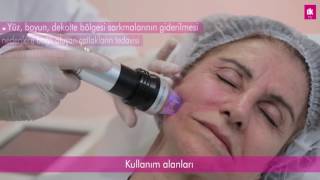 Intracel Altın İğne Tedavisi  Antalya  DK Klinik [upl. by Seaden]