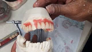 como enfilar una protesis dental  enfilado y festoneado  dentures [upl. by Lartnom]