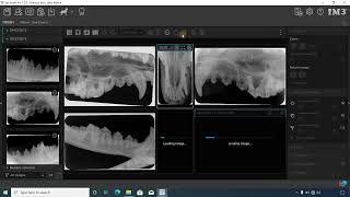 How to Create and Save Layouts for Dental XRays in the iM3 Software [upl. by Htinnek624]