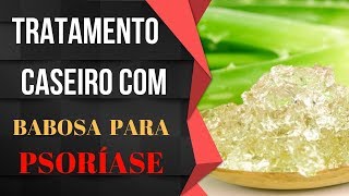 Psoríase Tratamento Caseiro Com Babosa 100 Natural [upl. by Monteria]