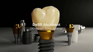 Introducing the DeSR Abutment—where esthetics meet innovation [upl. by Winola]