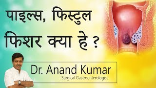 Hi9  पाइल्स फिस्टुलाफिशर क्या है  Dr  Ananda kumar Gastroenterologist [upl. by Schaper981]