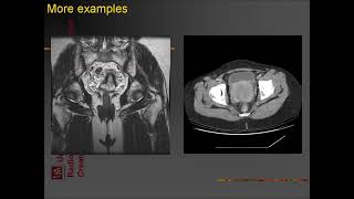 ultrasound radiologysonology [upl. by Aurlie]