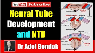 Neural Tube Development and Neural Tube Defects NTD Dr Adel Bondok [upl. by Eizzo540]