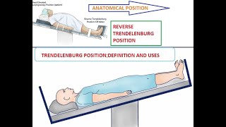 TRENDELENBURG POSITION  REVERSE TRENDELENBURG POSITION  DEFINITION AND USES [upl. by Ferrand281]