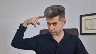 4 ways to tell Finasteride is working for hair loss [upl. by Wira]