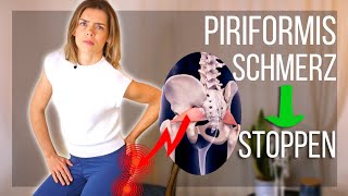 Wie du Schmerzen bei Piriformis Syndrom ANHALTEND beendest Test und Übungen [upl. by Afatsuom954]