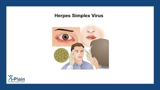 Herpes Simplex Virus [upl. by Russian]