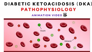 Pathophysiology of Diabetic Ketoacidosis DKA  Animation [upl. by Christos429]