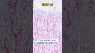 Osteogenesis Imperfecta in a Lamb [upl. by Anirbac403]