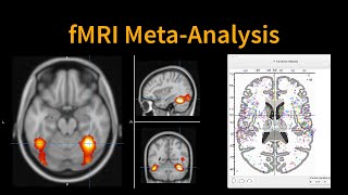 Introduction to fMRI MetaAnalysis [upl. by Johnsson862]