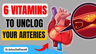 6 BEST Vitamins and Supplements to REMOVE PLAQUE From Your ARTERIES [upl. by Darin]