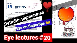 Eye lectures 20 retina retinitis pigmentosa [upl. by Yruok1]