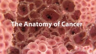 What Is Cancer What Causes Cancer amp How Is It Treated [upl. by Amandy350]