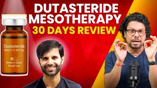 Dutasteride Mesotherapy 30 Days Review  Hair Loss  Hair Regrowth  Hair Tips  Adon Hair Care [upl. by Ecirb]