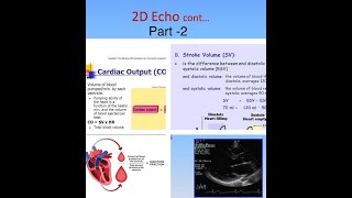 Basics of 2D Echo Part 2in Hindi  What is Ejection Fraction  What is EDV ESV SV and CO [upl. by Codel]