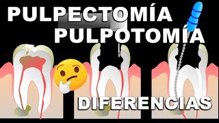 ⚠️ Procedimiento DENTAL en niños con caries muy profundas 📣 [upl. by Adelheid]