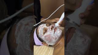 Hydra Facial 💆‍♀️skincare beautytreatment facialcleanup fypyoutube facial viralvideos [upl. by Treulich]