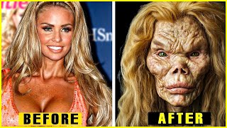 15 Hollywood Stars Plastic Surgery Disasters That Shocked the Public [upl. by Cornela]