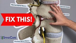 How to Fix a Bulging Disc in Your Lower Back  RELIEF IN SECONDS [upl. by Swihart]