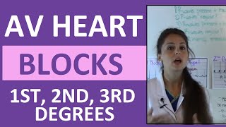 How to Interpret AV Heart Blocks Ekg Heart Rhythms  1st degree 2nd degree 3rd degree difference [upl. by Brooke]