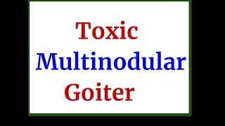 Toxic Multinodular Goiter [upl. by Leatrice]