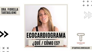 Ecocardiograma Doppler  Dra Fiorella Tartaglione [upl. by Sirrep]