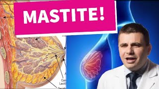 Mastite [upl. by Urbanus]