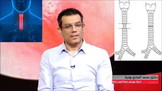 Sténose trachéale après intubation  Postintubation tracheal stenosis  تضيق القصبة الهوائية [upl. by Floro]