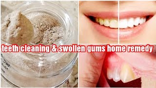 Teeth cleaning amp swollen gums home remedy teeth whitening at home plaque removalmanjan for teeth [upl. by Oderfla]