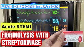 Fibrinolysis with streptokinase in acute STEMI  fibrinolisis pada STEMI serangan jantung berat [upl. by Rowley12]