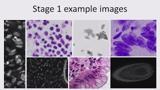 Kaggle Meetup Cell Nucleus Detection [upl. by Crim293]