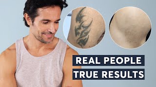 Laser Tattoo Removal  Real People True Results 2023 [upl. by Eillat951]