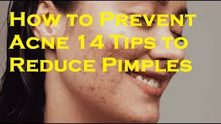 How to Prevent Acne 14 Tips to Reduce Pimples [upl. by Estrellita]