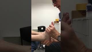 Ankle Fusion Patient 5 Months After Operation Showing Foots Range of Motion [upl. by Ohcirej746]