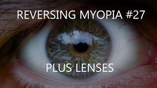 Reversing myopia 27  plus lenses [upl. by Samaj]