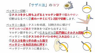 ソフトペッサリー サザエ法抜去のコツ How to remove vaginal pessary [upl. by Dorman201]