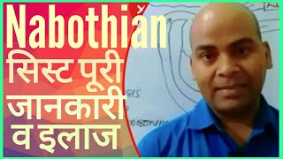 Nabothian Cyst Complete InfoNabothian सिस्ट पूरी जानकारी पूरा इलाजNabothian होता क्या है इलाज [upl. by Trow]