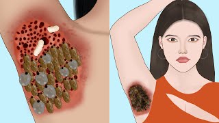 ASMR Remove dog ticks and maggots from infected armpit  Severely Injured animation [upl. by Rutter350]