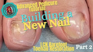 How to Repair a Toenail with LCNs Barefoot Toenail Restoration System  Part 2 [upl. by Llerrit]