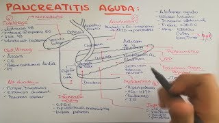 Pancreatitis causas fisiopatología clínica diagnóstico y tratamiento [upl. by Reynolds]