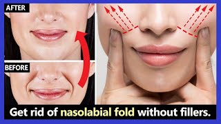 Quick Remove Smile lines Nasolabial Fold Lift Saggy Cheeks Fill Cheek lines  Short Time [upl. by Kreitman]