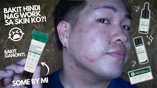 SOME BY MI AHA BHA PHA 30 DAYS MIRACLE STRATER SET  REVIEW FOR 30 DAYS BAKIT HINDI NAG WORK [upl. by Engdahl164]