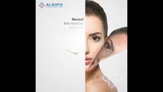 Revel the secrets with alshifas skin whitening treatment 🌿✨ cupping alshifacupping [upl. by Heilman595]