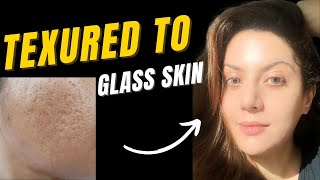 How to treat textured skin  Bumpy skin texture I Closed comedones treatment  Pitted scar treatment [upl. by Anyer]