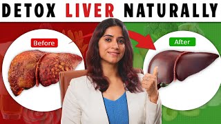 7 Ways to Cleanse Your Liver Naturally  By GunjanShouts [upl. by Sells]