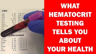 What Hematocrit Tells You About Your Health Hematology [upl. by Euqinomad26]