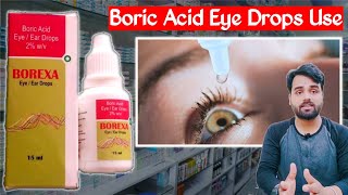 Boric acid eye drop  Boric acid powder uses  boric acid ke fayde  Medical jankari [upl. by Ahsieket]