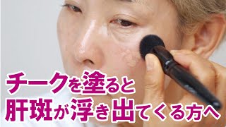 【肝斑さん】チークを塗ると肝斑が浮き出てしまう時の対策 [upl. by Natam]